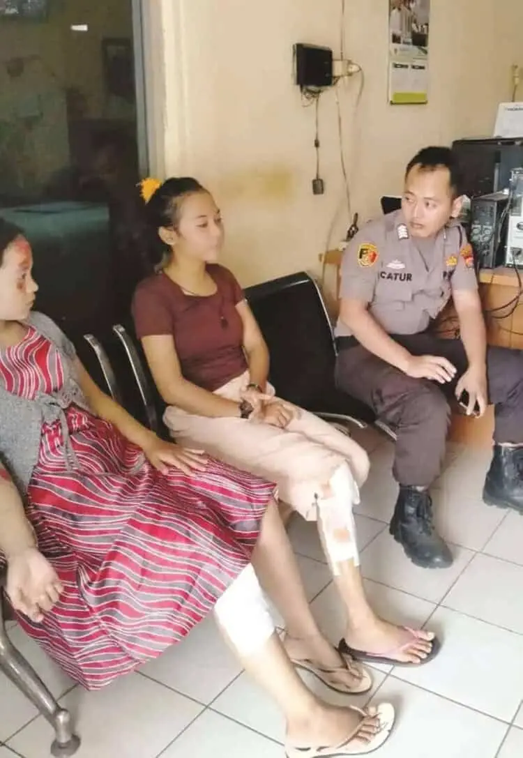 Melawan saat Dirampok, Dua Wanita Ini Selamat