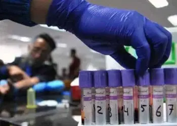 Rapid Test di DPRD Banten Sepi Peminat