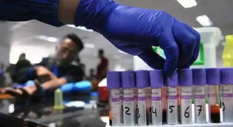 Rapid Test di DPRD Banten Sepi Peminat