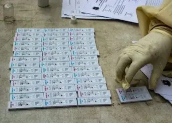 Pegawai Untirta dan RS Swasta Positif Covid-19 Tanpa Gejala