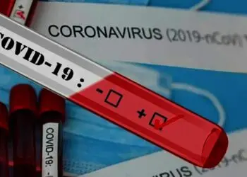 Polisi Ringkus Pemesan dan Pengguna Surat Tes Covid-19 Palsu