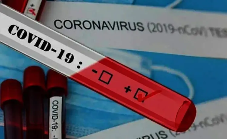Polisi Ringkus Pemesan dan Pengguna Surat Tes Covid-19 Palsu