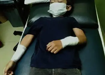 Anak 5 Tahun Bersimbah Darah Digigit Monyet di Perumahan Puspiptek