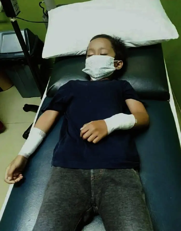 Anak 5 Tahun Bersimbah Darah Digigit Monyet di Perumahan Puspiptek