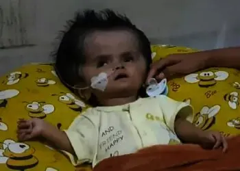 Bayi Laki-Laki Usia 1 Tahun Idap Penyakit Hydrocephalus