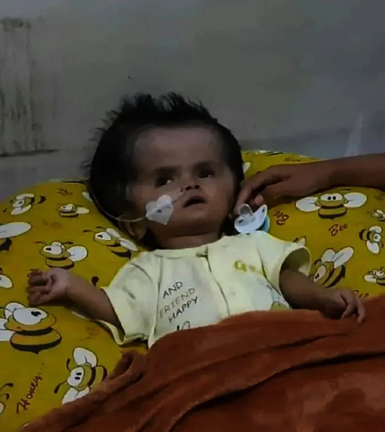 Bayi Laki-Laki Usia 1 Tahun Idap Penyakit Hydrocephalus