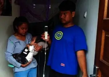 Bayi Penderita Hydrosefalus Pernah Ditolak Puskesmas