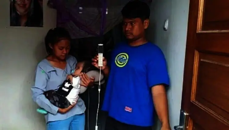 Bayi Penderita Hydrosefalus Pernah Ditolak Puskesmas