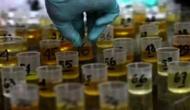 Kader DPC Demokrat Lebak akan Dites Urine
