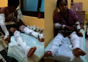 Elpiji 3 Kg Meledak, Suami Istri di Sajira Lebak Luka Bakar