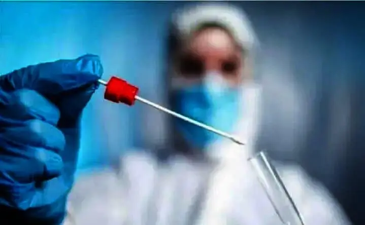 Lagi, Pemkab Terima Bantuan 500 Alat Swab Antigen dari PT.Supermall Karawaci