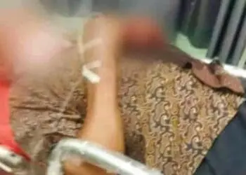 Tukang Rujak di Kresek Tangerang Dibacok Hingga Kritis