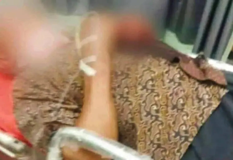 Tukang Rujak di Kresek Tangerang Dibacok Hingga Kritis