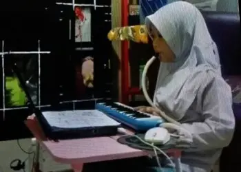 Anak Terlalu Sering Terpapar Layar Komputer? Ini Saran Dokter Mata RS Sari Asih