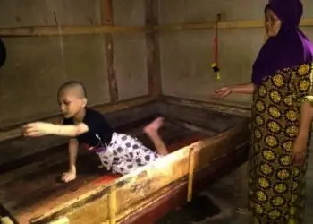 FATUROHMAN–Faturohman (12), di dalam kamar rumahnya, di Kampung Gunung Santri, Desa Pasir Eurih, Kecamatan Cipeucang, Kabupaten Pandeglang, Provinsi Banten, didampingi pengasuhnya, Minggu (1/8/2021). (MARDIANA/SATELITNEWS.ID)