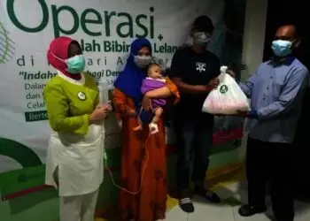 Peringati Hari Anak RS Sari Asih Serang Operasi Gratis Bibir Sumbing