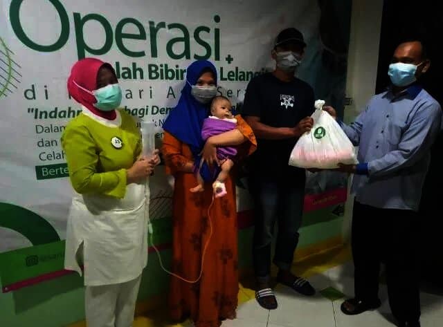 Peringati Hari Anak RS Sari Asih Serang Operasi Gratis Bibir Sumbing