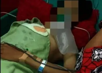 Diserang Tiga Orang tak Dikenal dengan Sajam, Siswa SMK di Lebak Tewas