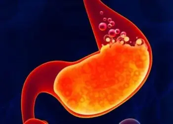 Asam Lambung Sering Naik? Yuk Ubah Gaya Hidup dengan Cara ini