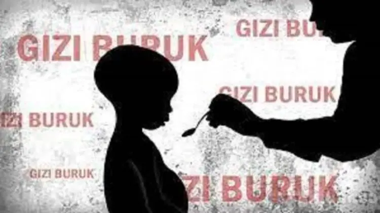 Seorang Balita Derita Gizi Buruk dan Hidrosefalus