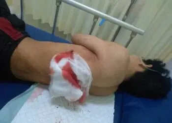 Tawuran Pelajar di Kota Tangerang, 3 Orang Kena Bacok, 6 Diamankan