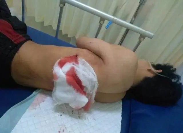 Tawuran Pelajar di Kota Tangerang, 3 Orang Kena Bacok, 6 Diamankan