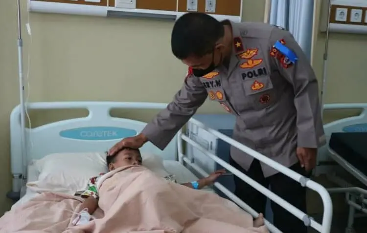 Gelar Baksos, Polda Banten Operasi Gratis 15 Orang Penderita Bibir Sumbing