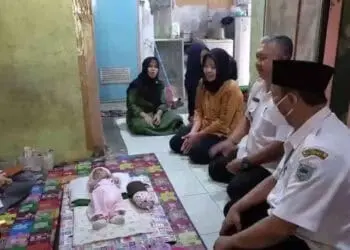 Bayi Tanpa Anus di Pandeglang Mendapat Pertolongan Pertama, Begini Harapan Keluarga