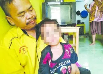 Bocah di Teluknaga Hobi Ngemil Semen dan Pasir