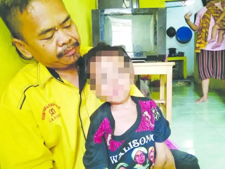 Bocah di Teluknaga Hobi Ngemil Semen dan Pasir