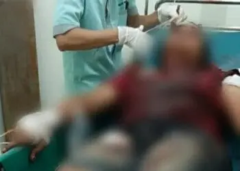 Sadis, Siang Asah Golok, Malam Hari Tetangga Sedang Santai Dibacok Hingga Sekarat