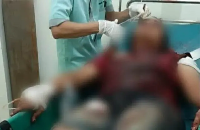 Sadis, Siang Asah Golok, Malam Hari Tetangga Sedang Santai Dibacok Hingga Sekarat