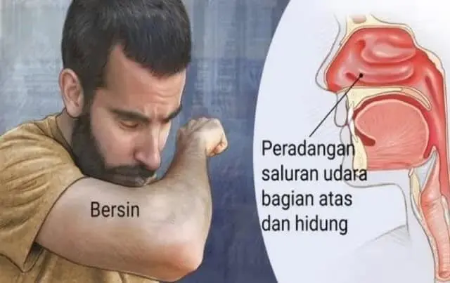 Musim Penghujan, Warga Lebak Diminta Waspadai ISPA