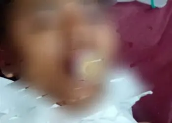 PERAWATAN: Seorang pria yang diduga pencuri mendapatkan perawatan di RSU Tangerang sebelum akhirnya meninggal dunia karena di kroyok masa Desa Ciakar, Kecamatan Panongan, Kamis (23/2). (ISTIMEWA)