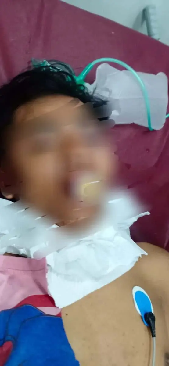 Diduga Pencuri, Seorang Pria Tewas Diamuk Warga
