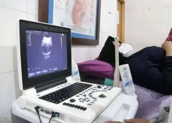 11 Puskesmas di Kota Tangerang Ini Beri Pelayanan USG Gratis