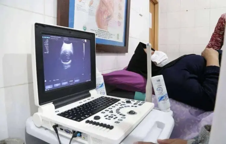 11 Puskesmas di Kota Tangerang Ini Beri Pelayanan USG Gratis
