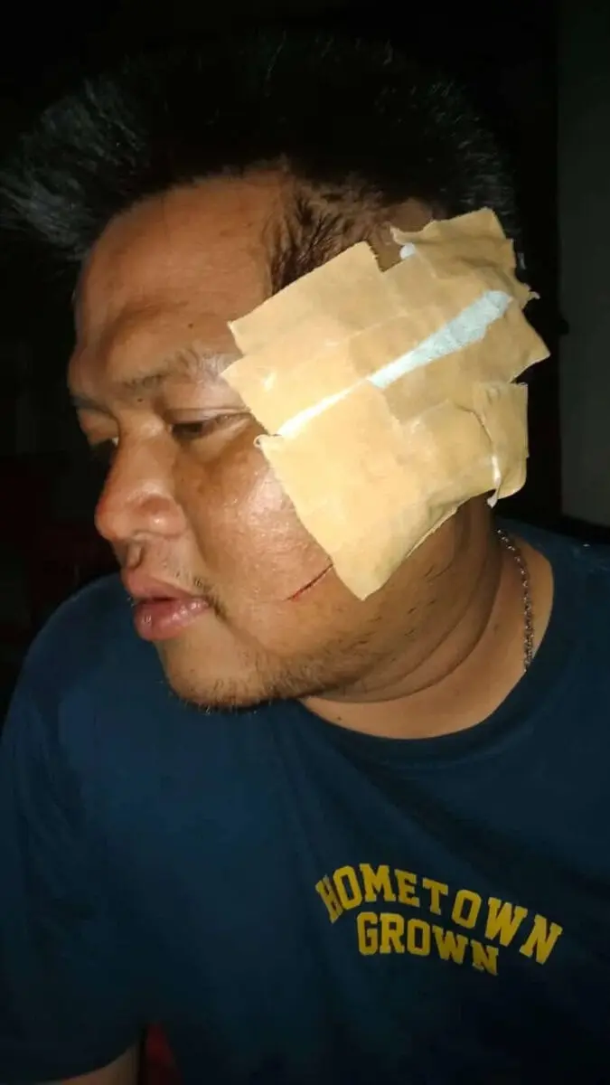Habis Bacok Temannya Sendiri, Pelaku Kabur dari Pandeglang, Begini Kondisi Korban Terkini
