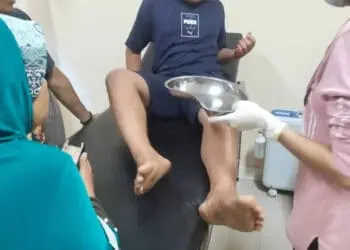Diserang Lutung, Begini Kondisi Korban Asal Cigeulis Kabupaten Pandeglang Ini