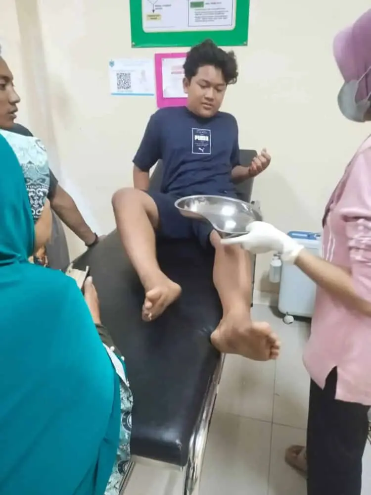 Diserang Lutung, Begini Kondisi Korban Asal Cigeulis Kabupaten Pandeglang Ini