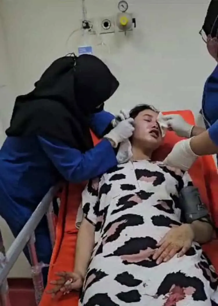 Suami di Serpong Tega Aniaya Istri Yang Sedang Hamil 4 Bulan