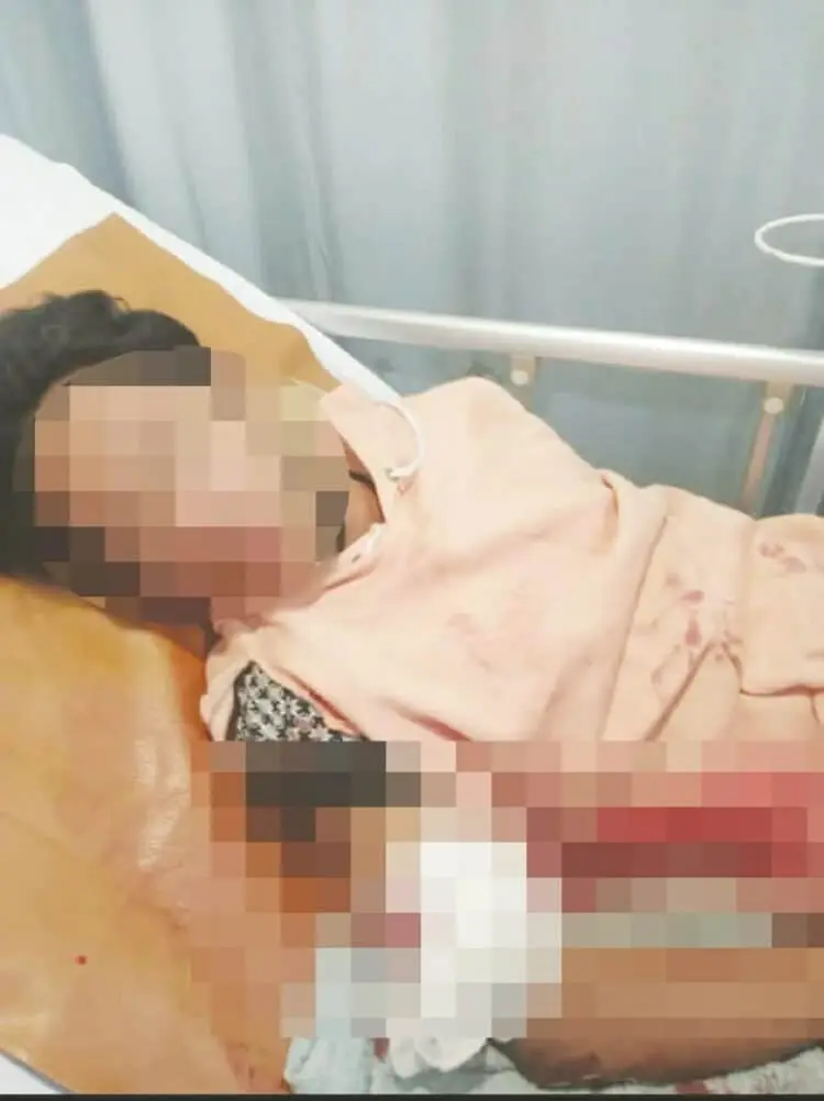 Dua Remaja Derita Luka Bacok Usai Diserang Gangster di Ciputat