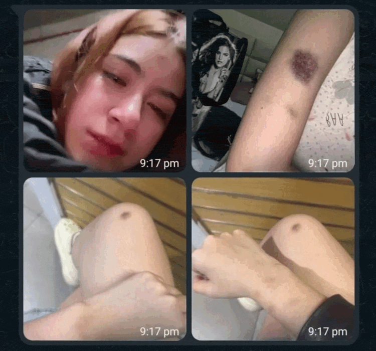 Ibu Rinoa Aurora Sebut Putrinya Sudah 2 Kali Dianiaya Leon Dozan