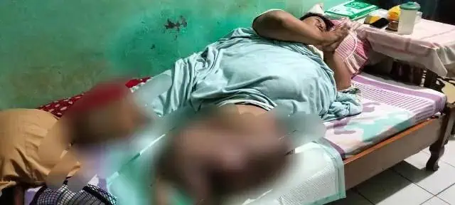 Diduga Alami Penyakit Aneh, Kaki Seorang Warga Solear Membengkak