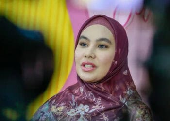 Usai Jalani Pengobatan, Wajah Melepuh Kartika Putri Sudah Mambaik