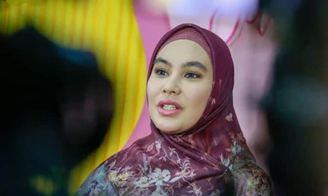 Usai Jalani Pengobatan, Wajah Melepuh Kartika Putri Sudah Mambaik