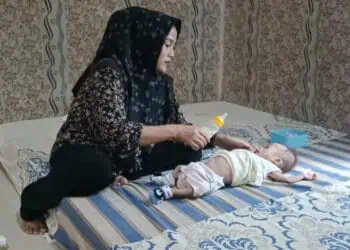 Butuh Bantuan, Bayi Mungil di Pandeglang Mengidap Pembengkakan di Perut 