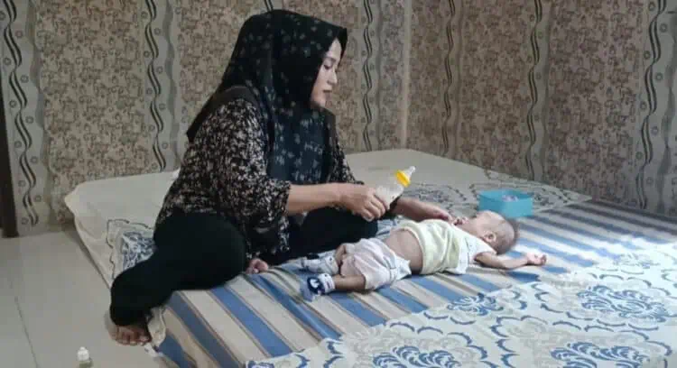 Butuh Bantuan, Bayi Mungil di Pandeglang Mengidap Pembengkakan di Perut