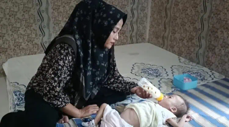 Bayi Mungil di Pandeglang Mengidap Pembengkakan di Perut, Begini Kata Kapus Sumur