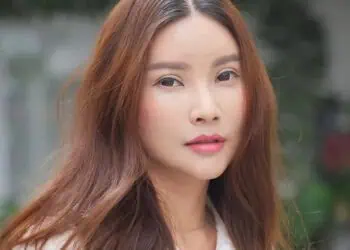 Pasca Oplas, Wajah Sarwendah Mirip Inul